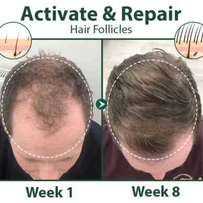 PELO_ANTES_Y_DESPUES_2_1440x1440_e7130e80-13f5-4c68-a854-252613f7c7b0