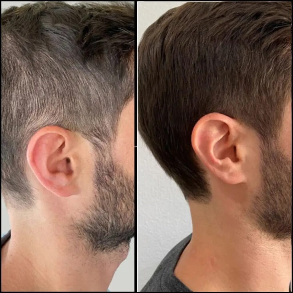 Página-Shampoo-Canas-_10_-_1_