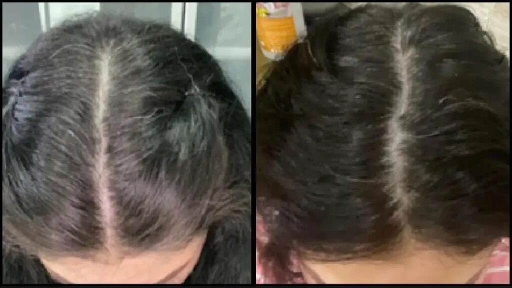 Página-Shampoo-Canas-_5_-_1_