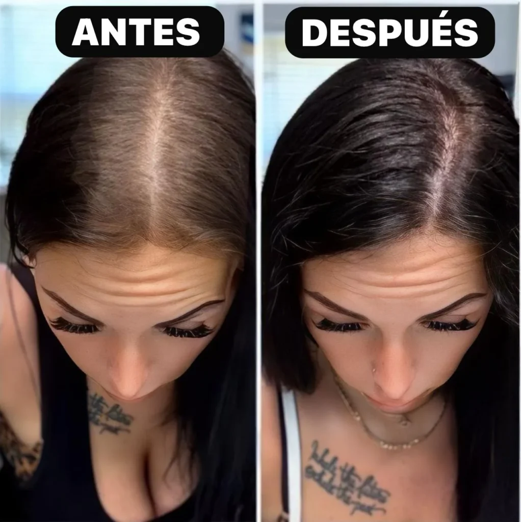 antes-despues_2c0220a2-0b36-4f0a-8b7a-010cafb513f8